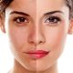 2 tratament cosmetic tratament gerovital peeling facial tratament acnee masca fata salon Campina coafor
